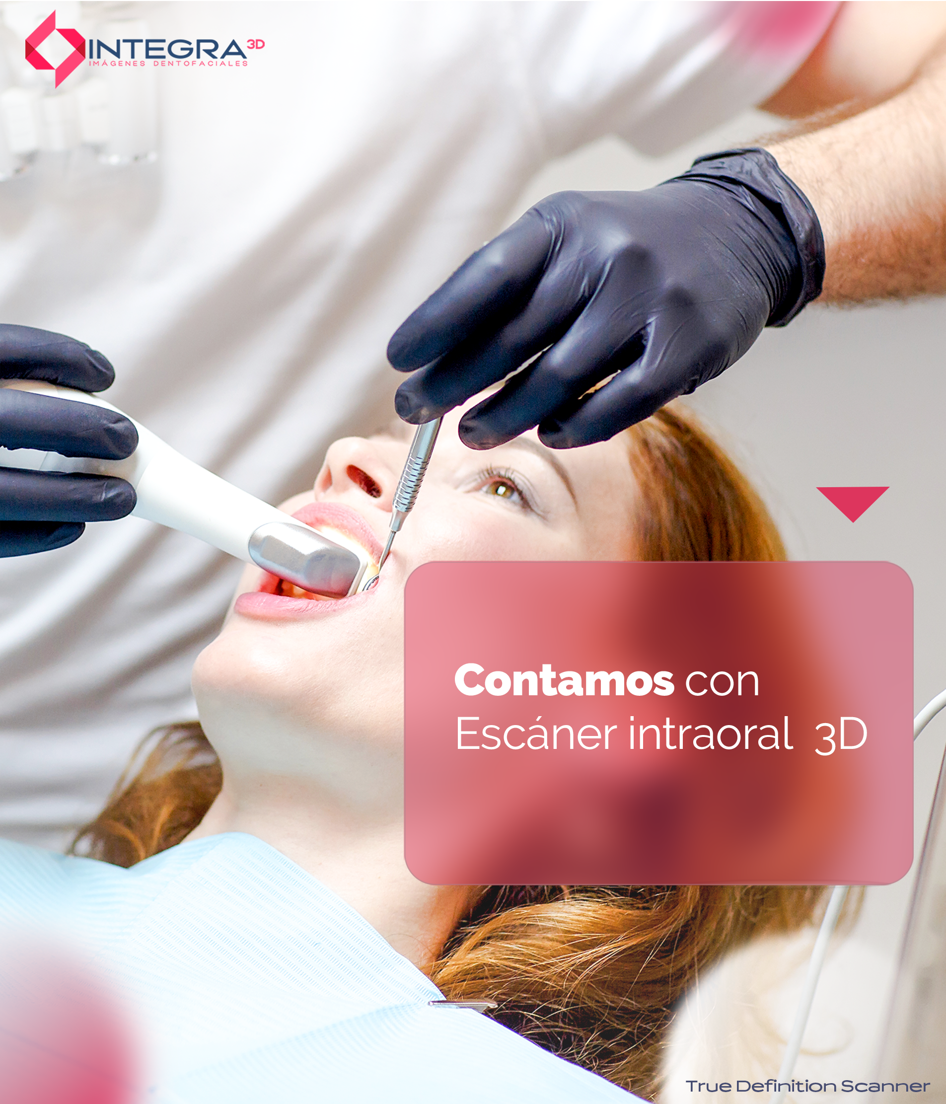 Escáner Intraoral a Domicilio 2