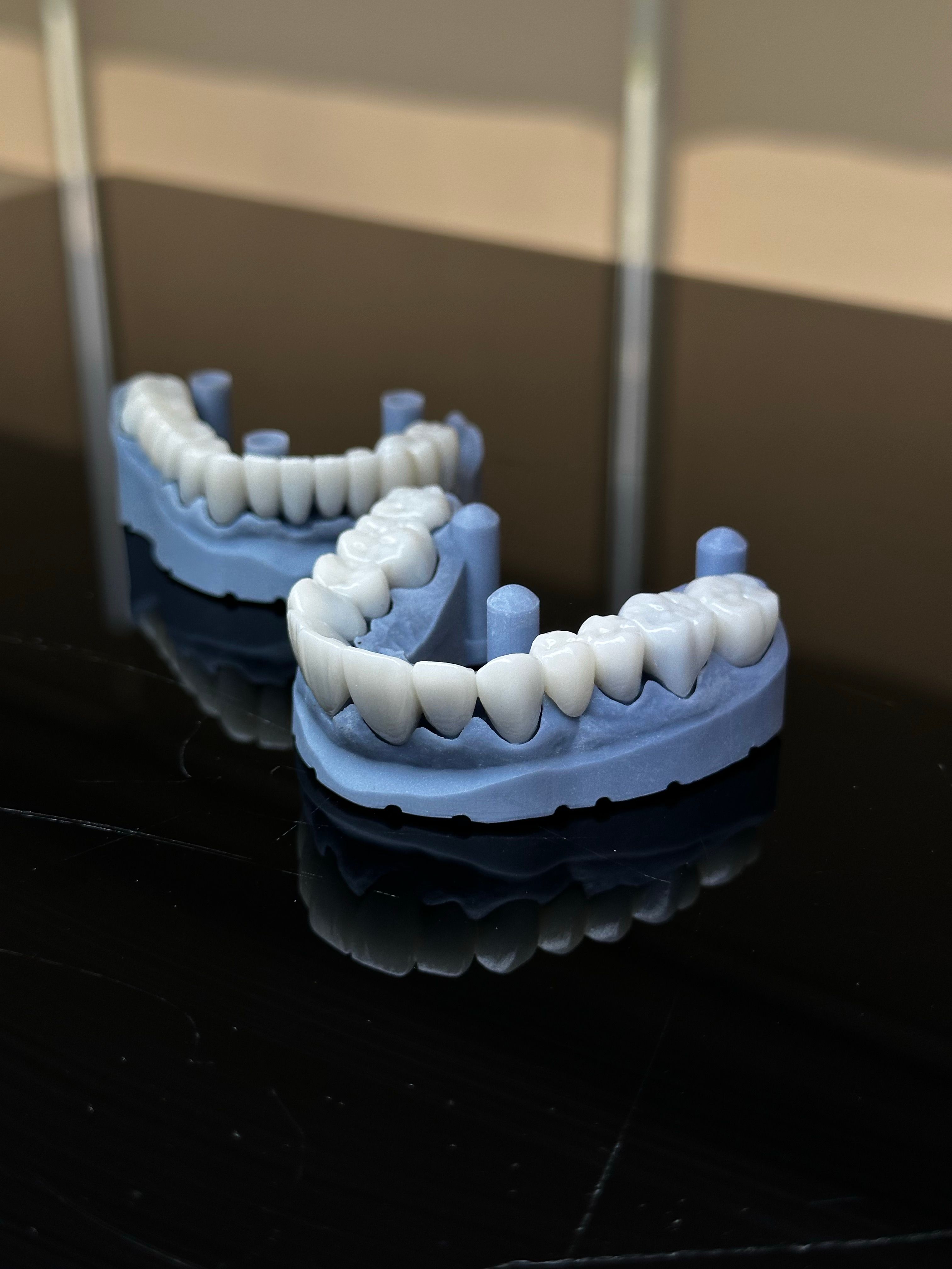 Impresión 3D & Alineadores 2