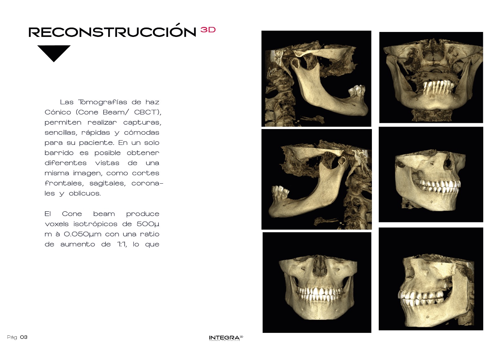 Planificación de Implantes Compleja