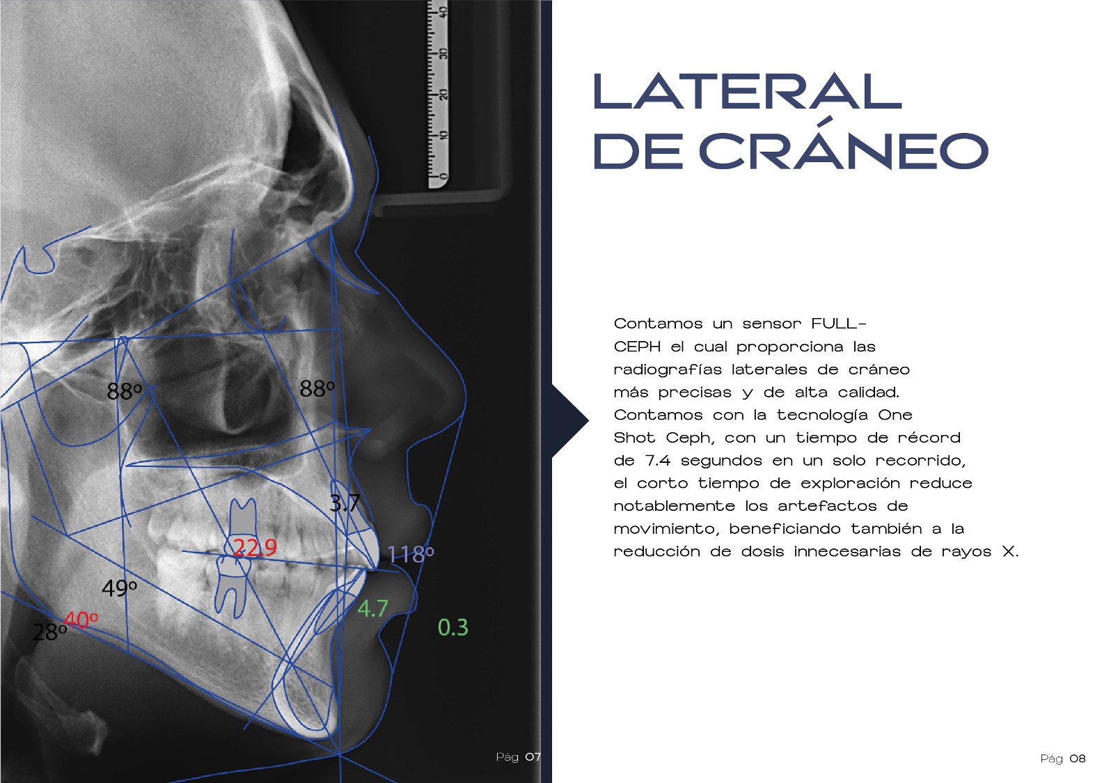 Lateral de Cráneo