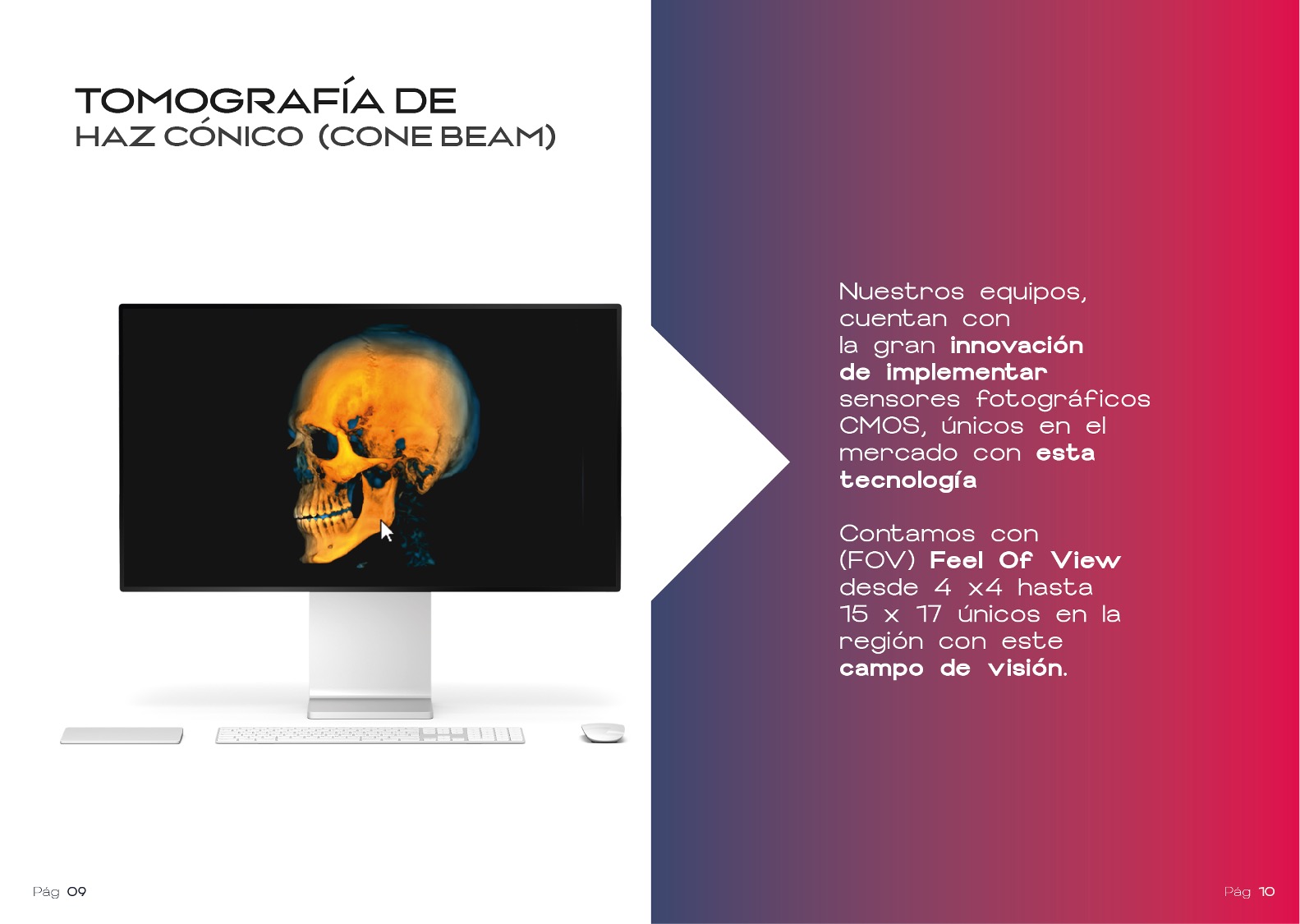 Tomografía Cone Beam