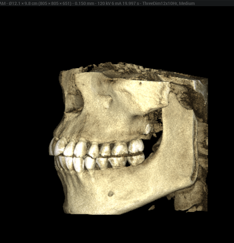 Tomografía 3D 4